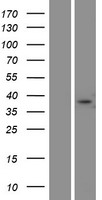 Western blot validation of overexpression lysate (Cat# LY408610) using anti-DDK antibody (Cat# TA50011-100). Left: Cell lysates from un-transfected HEK293T cells; Right: Cell lysates from HEK293T cells transfected with RC215264 using transfection reagent MegaTran 2.0 (Cat# TT210002).
