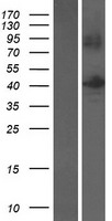 Western blot validation of overexpression lysate (Cat# LY423147) using anti-DDK antibody (Cat# TA50011-100). Left: Cell lysates from un-transfected HEK293T cells; Right: Cell lysates from HEK293T cells transfected with RC215480 using transfection reagent MegaTran 2.0 (Cat# TT210002).
