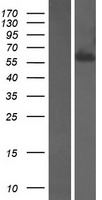 Western blot validation of overexpression lysate (Cat# LY405897) using anti-DDK antibody (Cat# TA50011-100). Left: Cell lysates from un-transfected HEK293T cells; Right: Cell lysates from HEK293T cells transfected with RC215386 using transfection reagent MegaTran 2.0 (Cat# TT210002).