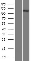 Western blot validation of overexpression lysate (Cat# LY421986) using anti-DDK antibody (Cat# TA50011-100). Left: Cell lysates from un-transfected HEK293T cells; Right: Cell lysates from HEK293T cells transfected with RC215364 using transfection reagent MegaTran 2.0 (Cat# TT210002).