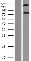 Western blot validation of overexpression lysate (Cat# LY414679) using anti-DDK antibody (Cat# TA50011-100). Left: Cell lysates from un-transfected HEK293T cells; Right: Cell lysates from HEK293T cells transfected with RC214952 using transfection reagent MegaTran 2.0 (Cat# TT210002).