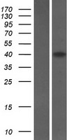 Western blot validation of overexpression lysate (Cat# LY420960) using anti-DDK antibody (Cat# TA50011-100). Left: Cell lysates from un-transfected HEK293T cells; Right: Cell lysates from HEK293T cells transfected with RC214901 using transfection reagent MegaTran 2.0 (Cat# TT210002).