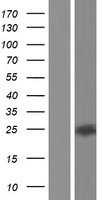 Western blot validation of overexpression lysate (Cat# LY421066) using anti-DDK antibody (Cat# TA50011-100). Left: Cell lysates from un-transfected HEK293T cells; Right: Cell lysates from HEK293T cells transfected with RC214864 using transfection reagent MegaTran 2.0 (Cat# TT210002).