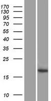 Western blot validation of overexpression lysate (Cat# LY421664) using anti-DDK antibody (Cat# TA50011-100). Left: Cell lysates from un-transfected HEK293T cells; Right: Cell lysates from HEK293T cells transfected with RC215137 using transfection reagent MegaTran 2.0 (Cat# TT210002).