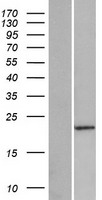 Western blot validation of overexpression lysate (Cat# LY422939) using anti-DDK antibody (Cat# TA50011-100). Left: Cell lysates from un-transfected HEK293T cells; Right: Cell lysates from HEK293T cells transfected with RC215091 using transfection reagent MegaTran 2.0 (Cat# TT210002).