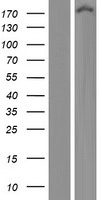 Western blot validation of overexpression lysate (Cat# LY421616) using anti-DDK antibody (Cat# TA50011-100). Left: Cell lysates from un-transfected HEK293T cells; Right: Cell lysates from HEK293T cells transfected with RC215843 using transfection reagent MegaTran 2.0 (Cat# TT210002).
