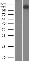 Western blot validation of overexpression lysate (Cat# LY420203) using anti-DDK antibody (Cat# TA50011-100). Left: Cell lysates from un-transfected HEK293T cells; Right: Cell lysates from HEK293T cells transfected with RC216074 using transfection reagent MegaTran 2.0 (Cat# TT210002).