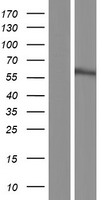 Western blot validation of overexpression lysate (Cat# LY414475) using anti-DDK antibody (Cat# TA50011-100). Left: Cell lysates from un-transfected HEK293T cells; Right: Cell lysates from HEK293T cells transfected with RC216069 using transfection reagent MegaTran 2.0 (Cat# TT210002).