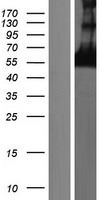 Western blot validation of overexpression lysate (Cat# LY409888) using anti-DDK antibody (Cat# TA50011-100). Left: Cell lysates from un-transfected HEK293T cells; Right: Cell lysates from HEK293T cells transfected with RC220433 using transfection reagent MegaTran 2.0 (Cat# TT210002).