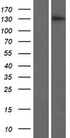 Western blot validation of overexpression lysate (Cat# LY414389) using anti-DDK antibody (Cat# TA50011-100). Left: Cell lysates from un-transfected HEK293T cells; Right: Cell lysates from HEK293T cells transfected with RC215683 using transfection reagent MegaTran 2.0 (Cat# TT210002).