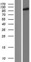 Western blot validation of overexpression lysate (Cat# LY421636) using anti-DDK antibody (Cat# TA50011-100). Left: Cell lysates from un-transfected HEK293T cells; Right: Cell lysates from HEK293T cells transfected with RC215535 using transfection reagent MegaTran 2.0 (Cat# TT210002).