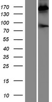 Western blot validation of overexpression lysate (Cat# LY419057) using anti-DDK antibody (Cat# TA50011-100). Left: Cell lysates from un-transfected HEK293T cells; Right: Cell lysates from HEK293T cells transfected with RC215526 using transfection reagent MegaTran 2.0 (Cat# TT210002).