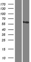 Western blot validation of overexpression lysate (Cat# LY411909) using anti-DDK antibody (Cat# TA50011-100). Left: Cell lysates from un-transfected HEK293T cells; Right: Cell lysates from HEK293T cells transfected with RC215511 using transfection reagent MegaTran 2.0 (Cat# TT210002).