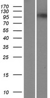 Western blot validation of overexpression lysate (Cat# LY405599) using anti-DDK antibody (Cat# TA50011-100). Left: Cell lysates from un-transfected HEK293T cells; Right: Cell lysates from HEK293T cells transfected with RC215670 using transfection reagent MegaTran 2.0 (Cat# TT210002).