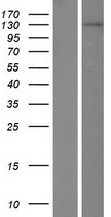 Western blot validation of overexpression lysate (Cat# LY404794) using anti-DDK antibody (Cat# TA50011-100). Left: Cell lysates from un-transfected HEK293T cells; Right: Cell lysates from HEK293T cells transfected with RC215743 using transfection reagent MegaTran 2.0 (Cat# TT210002).