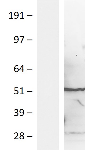 Western blot validation of overexpression lysate (Cat# LY420346) using anti-DDK antibody (Cat# TA50011-100). Left: Cell lysates from un-transfected HEK293T cells; Right: Cell lysates from HEK293T cells transfected with RC214041 using transfection reagent MegaTran 2.0 (Cat# TT210002).