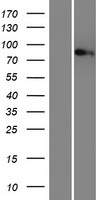 Western blot validation of overexpression lysate (Cat# LY421764) using anti-DDK antibody (Cat# TA50011-100). Left: Cell lysates from un-transfected HEK293T cells; Right: Cell lysates from HEK293T cells transfected with RC214077 using transfection reagent MegaTran 2.0 (Cat# TT210002).