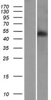 Western blot validation of overexpression lysate (Cat# LY404932) using anti-DDK antibody (Cat# TA50011-100). Left: Cell lysates from un-transfected HEK293T cells; Right: Cell lysates from HEK293T cells transfected with RC214046 using transfection reagent MegaTran 2.0 (Cat# TT210002).