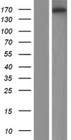 Western blot validation of overexpression lysate (Cat# LY404869) using anti-DDK antibody (Cat# TA50011-100). Left: Cell lysates from un-transfected HEK293T cells; Right: Cell lysates from HEK293T cells transfected with RC213674 using transfection reagent MegaTran 2.0 (Cat# TT210002).