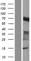 Western blot validation of overexpression lysate (Cat# LY421650) using anti-DDK antibody (Cat# TA50011-100). Left: Cell lysates from un-transfected HEK293T cells; Right: Cell lysates from HEK293T cells transfected with RC214649 using transfection reagent MegaTran 2.0 (Cat# TT210002).