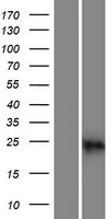 Western blot validation of overexpression lysate (Cat# LY413985) using anti-DDK antibody (Cat# TA50011-100). Left: Cell lysates from un-transfected HEK293T cells; Right: Cell lysates from HEK293T cells transfected with RC214556 using transfection reagent MegaTran 2.0 (Cat# TT210002).