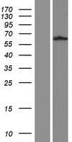 Western blot validation of overexpression lysate (Cat# LY406065) using anti-DDK antibody (Cat# TA50011-100). Left: Cell lysates from un-transfected HEK293T cells; Right: Cell lysates from HEK293T cells transfected with RC214538 using transfection reagent MegaTran 2.0 (Cat# TT210002).