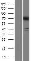 Western blot validation of overexpression lysate (Cat# LY421476) using anti-DDK antibody (Cat# TA50011-100). Left: Cell lysates from un-transfected HEK293T cells; Right: Cell lysates from HEK293T cells transfected with RC214807 using transfection reagent MegaTran 2.0 (Cat# TT210002).