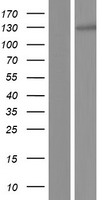 Western blot validation of overexpression lysate (Cat# LY409574) using anti-DDK antibody (Cat# TA50011-100). Left: Cell lysates from un-transfected HEK293T cells; Right: Cell lysates from HEK293T cells transfected with RC214806 using transfection reagent MegaTran 2.0 (Cat# TT210002).