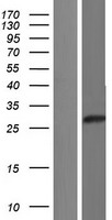 Western blot validation of overexpression lysate (Cat# LY404009) using anti-DDK antibody (Cat# TA50011-100). Left: Cell lysates from un-transfected HEK293T cells; Right: Cell lysates from HEK293T cells transfected with RC214695 using transfection reagent MegaTran 2.0 (Cat# TT210002).