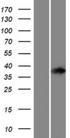 Western blot validation of overexpression lysate (Cat# LY428703) using anti-DDK antibody (Cat# TA50011-100). Left: Cell lysates from un-transfected HEK293T cells; Right: Cell lysates from HEK293T cells transfected with RC226628 using transfection reagent MegaTran 2.0 (Cat# TT210002).