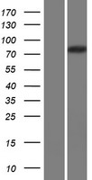 Western blot validation of overexpression lysate (Cat# LY428704) using anti-DDK antibody (Cat# TA50011-100). Left: Cell lysates from un-transfected HEK293T cells; Right: Cell lysates from HEK293T cells transfected with RC226657 using transfection reagent MegaTran 2.0 (Cat# TT210002).