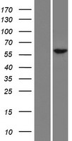 Western blot validation of overexpression lysate (Cat# LY428962) using anti-DDK antibody (Cat# TA50011-100). Left: Cell lysates from un-transfected HEK293T cells; Right: Cell lysates from HEK293T cells transfected with RC226831 using transfection reagent MegaTran 2.0 (Cat# TT210002).