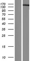 Western blot validation of overexpression lysate (Cat# LY429444) using anti-DDK antibody (Cat# TA50011-100). Left: Cell lysates from un-transfected HEK293T cells; Right: Cell lysates from HEK293T cells transfected with RC226817 using transfection reagent MegaTran 2.0 (Cat# TT210002).