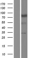 Western blot validation of overexpression lysate (Cat# LY428449) using anti-DDK antibody (Cat# TA50011-100). Left: Cell lysates from un-transfected HEK293T cells; Right: Cell lysates from HEK293T cells transfected with RC227208 using transfection reagent MegaTran 2.0 (Cat# TT210002).