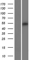 Western blot validation of overexpression lysate (Cat# LY428719) using anti-DDK antibody (Cat# TA50011-100). Left: Cell lysates from un-transfected HEK293T cells; Right: Cell lysates from HEK293T cells transfected with RC226882 using transfection reagent MegaTran 2.0 (Cat# TT210002).