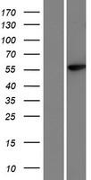 Western blot validation of overexpression lysate (Cat# LY428685) using anti-DDK antibody (Cat# TA50011-100). Left: Cell lysates from un-transfected HEK293T cells; Right: Cell lysates from HEK293T cells transfected with RC227170 using transfection reagent MegaTran 2.0 (Cat# TT210002).