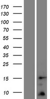 Western blot validation of overexpression lysate (Cat# LY427456) using anti-DDK antibody (Cat# TA50011-100). Left: Cell lysates from un-transfected HEK293T cells; Right: Cell lysates from HEK293T cells transfected with RC225008 using transfection reagent MegaTran 2.0 (Cat# TT210002).