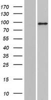 Western blot validation of overexpression lysate (Cat# LY428529) using anti-DDK antibody (Cat# TA50011-100). Left: Cell lysates from un-transfected HEK293T cells; Right: Cell lysates from HEK293T cells transfected with RC227365 using transfection reagent MegaTran 2.0 (Cat# TT210002).