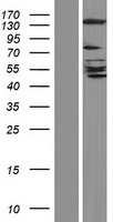 Western blot validation of overexpression lysate (Cat# LY428702) using anti-DDK antibody (Cat# TA50011-100). Left: Cell lysates from un-transfected HEK293T cells; Right: Cell lysates from HEK293T cells transfected with RC227339 using transfection reagent MegaTran 2.0 (Cat# TT210002).