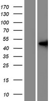 Western blot validation of overexpression lysate (Cat# LY428990) using anti-DDK antibody (Cat# TA50011-100). Left: Cell lysates from un-transfected HEK293T cells; Right: Cell lysates from HEK293T cells transfected with RC226928 using transfection reagent MegaTran 2.0 (Cat# TT210002).