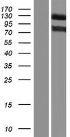 Western blot validation of overexpression lysate (Cat# LY429468) using anti-DDK antibody (Cat# TA50011-100). Left: Cell lysates from un-transfected HEK293T cells; Right: Cell lysates from HEK293T cells transfected with RC227132 using transfection reagent MegaTran 2.0 (Cat# TT210002).