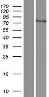Western blot validation of overexpression lysate (Cat# LY428743) using anti-DDK antibody (Cat# TA50011-100). Left: Cell lysates from un-transfected HEK293T cells; Right: Cell lysates from HEK293T cells transfected with RC227138 using transfection reagent MegaTran 2.0 (Cat# TT210002).