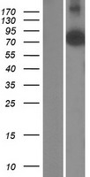 Western blot validation of overexpression lysate (Cat# LY428460) using anti-DDK antibody (Cat# TA50011-100). Left: Cell lysates from un-transfected HEK293T cells; Right: Cell lysates from HEK293T cells transfected with RC227075 using transfection reagent MegaTran 2.0 (Cat# TT210002).