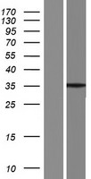 Western blot validation of overexpression lysate (Cat# LY427085) using anti-DDK antibody (Cat# TA50011-100). Left: Cell lysates from un-transfected HEK293T cells; Right: Cell lysates from HEK293T cells transfected with RC225306 using transfection reagent MegaTran 2.0 (Cat# TT210002).