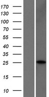 Western blot validation of overexpression lysate (Cat# LY426152) using anti-DDK antibody (Cat# TA50011-100). Left: Cell lysates from un-transfected HEK293T cells; Right: Cell lysates from HEK293T cells transfected with RC225286 using transfection reagent MegaTran 2.0 (Cat# TT210002).