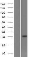 Western blot validation of overexpression lysate (Cat# LY429331) using anti-DDK antibody (Cat# TA50011-100). Left: Cell lysates from un-transfected HEK293T cells; Right: Cell lysates from HEK293T cells transfected with RC225329 using transfection reagent MegaTran 2.0 (Cat# TT210002).