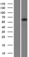 Western blot validation of overexpression lysate (Cat# LY426295) using anti-DDK antibody (Cat# TA50011-100). Left: Cell lysates from un-transfected HEK293T cells; Right: Cell lysates from HEK293T cells transfected with RC225421 using transfection reagent MegaTran 2.0 (Cat# TT210002).