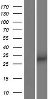 Western blot validation of overexpression lysate (Cat# LY426595) using anti-DDK antibody (Cat# TA50011-100). Left: Cell lysates from un-transfected HEK293T cells; Right: Cell lysates from HEK293T cells transfected with RC225401 using transfection reagent MegaTran 2.0 (Cat# TT210002).