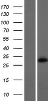 Western blot validation of overexpression lysate (Cat# LY426283) using anti-DDK antibody (Cat# TA50011-100). Left: Cell lysates from un-transfected HEK293T cells; Right: Cell lysates from HEK293T cells transfected with RC225396 using transfection reagent MegaTran 2.0 (Cat# TT210002).