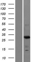 Western blot validation of overexpression lysate (Cat# LY426628) using anti-DDK antibody (Cat# TA50011-100). Left: Cell lysates from un-transfected HEK293T cells; Right: Cell lysates from HEK293T cells transfected with RC225388 using transfection reagent MegaTran 2.0 (Cat# TT210002).